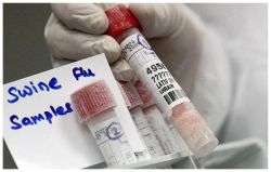 Israel finds 17 more A/H1N1 flu cases