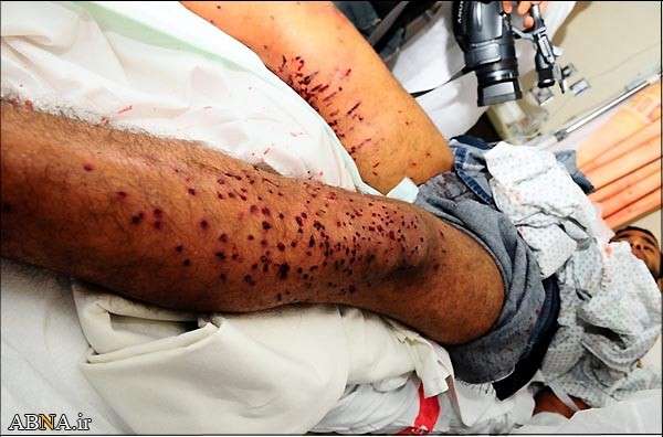 بحرین میں نہتے عوام پر بحرینی اور سعودی سیکورٹی فورسز کا وحشیانہ تشدد