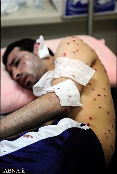 بحرین میں نہتے عوام پر بحرینی اور سعودی سیکورٹی فورسز کا وحشیانہ تشدد