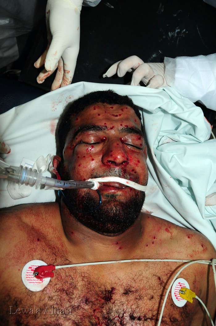 Crimes of Al saud and Al khalifa in Bahrain