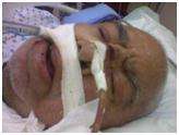 Al-Khalifa authorities kill an elderly with tear gas
