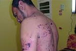 شکنجه بحرینی‌ها در خارج از زندان‌ها و مراکز پلیس صورت می‌گیرد