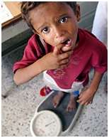 IRIN report on Malnutrition in Yemen