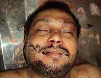 کراچی میں فائرنگ، دو افراد جاں بحق جبکہ سینئر سول جج سید ظہیر احمد زخمی