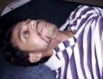 گلگت شہر میں فائرنگ کے نتیجے میں زخمی ہونے والا شیعہ نوجوان شہید