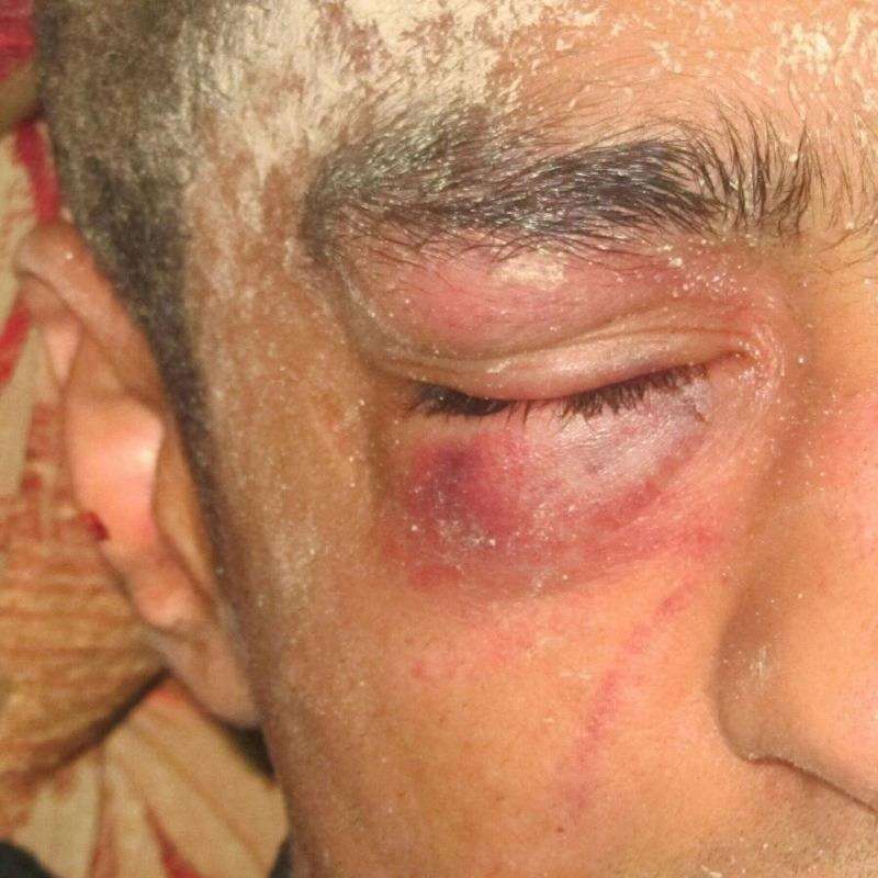 جنایات جدید مزدوران آل خلیفه؛ ضرب و شتم و تجاوز جنسی 15 کودک بیگناه بحرینی