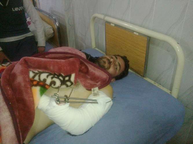 سانحہ ہنگو میں زخمی ہونیوالے ایل آر ایچ پشاور میں زیر علاج