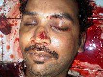 کراچی، دہشتگردوں کی فائرنگ سے سید قمر رضا نقوی شہید ہو گئے