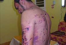 سوزاندن بدن و تهدید شهروندان بحرینی به هتک حرمت؛ تنها گوشه ای از جنایات آل خلیفه!