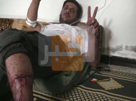 إصابة "أبو صقار" آكل قلب الجندي السوري بجروح