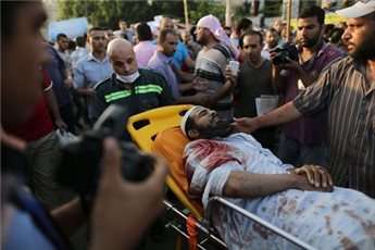 An injured man is brought on a stretcher for medical treatment in Cairo following overnight violence, on July 8.
