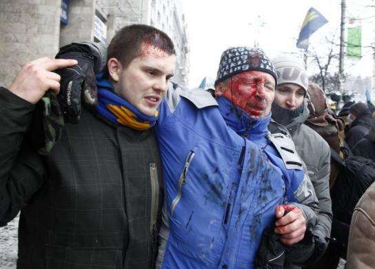 A man reacts after he was injured during a rally held by pro-European protesters in Kiev January 22 2014.