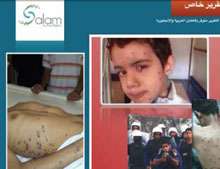 شوزن؛ سلاحی برای کشتار مردم بحرین