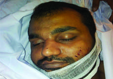 کراچی، تکفیری دہشت گردوں کی فائرنگ، شیعت نیوز ٹیم کے رکن عدیل عباس شہید، 2 ساتھی زخمی