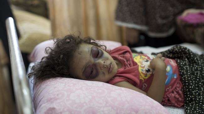 Two-year-old Palestinian girl Naama Abu al-Foul sleeps after undergoing treatment at Gaza City’s Al-Shifa hospital following Israeli bombing next to her family’s home in the battered city, July 23, 2014.