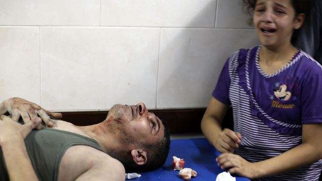 A Palestinian girl cries as her father, wounded in an Israeli air strike on the al-Shati refugee camp, is treated at the al-Shifa hospital in Gaza City, on August 4, 2014.