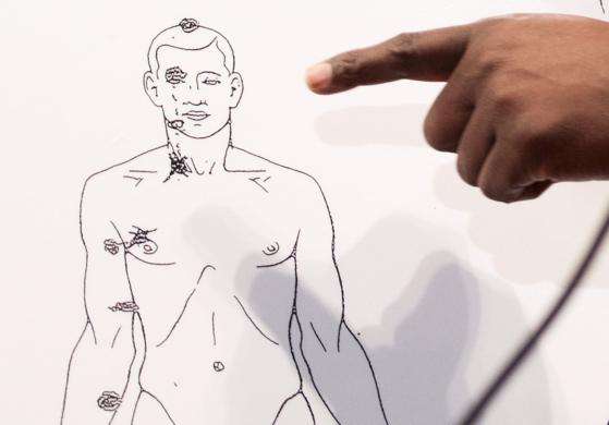 Brown family attorney Daryl Parks points on an autopsy diagram to the head wound that was likely fatal to Michael Brown during a news conference in Ferguson, Missouri August 18, 2014.