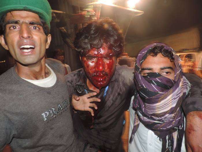 اسلام آباد ریڈزون میں انقلاب اور آزادی مارچ پر شیلنگ اور فائرنگ کے باوجود مظاہرین کیطرف سے سخت مزاحمت
