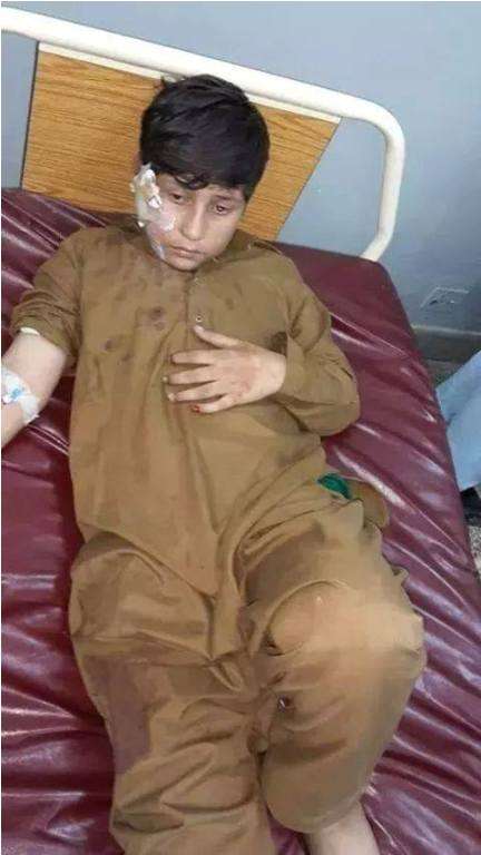 کوہاٹ بم دھماکہ میں زخمی ہونے والا بچہ