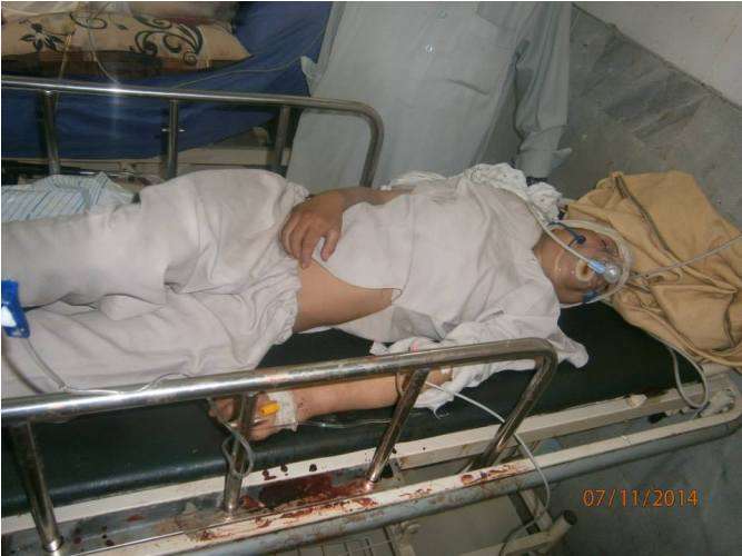 یوم عاشورہ اورکزئی ایجنسی دھماکہ کے زخمی پشاور میں زیر علاج