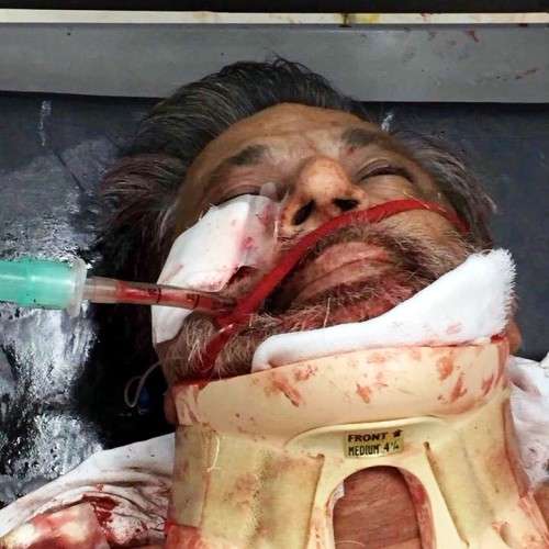 کراچی میں ایم کیو ایم کے سینئر رہنما رشید گوڈیل پر قاتلانہ حملہ