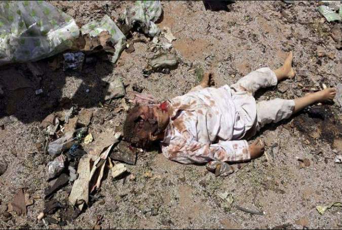 چرا مرگ کودکان یمنی برای کسی مهم نیست؟!