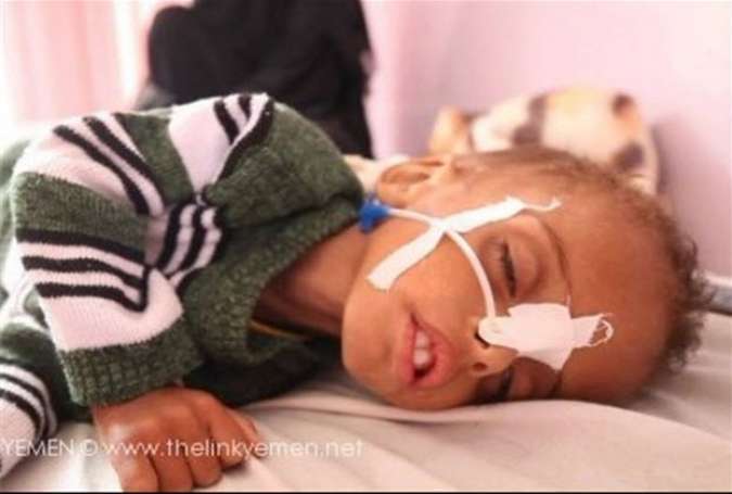 7495 شهید و 16058 زخمی، حاصل تجاوز عربستان به مردم مسلمان یمن