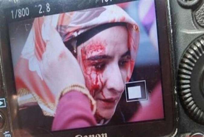 A woman holds her hand against her bleeding face in front of the headquarters of Zaman newspaper in Istanbul, Turkey.
