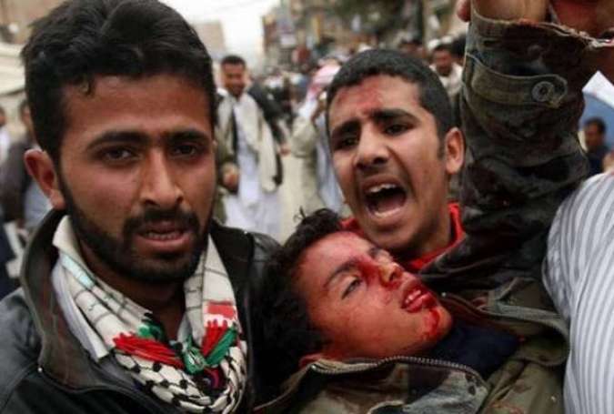 بیش از ۲۳ هزار نفر از آغاز تجاوز عربستان به یمن زخمی شده اند