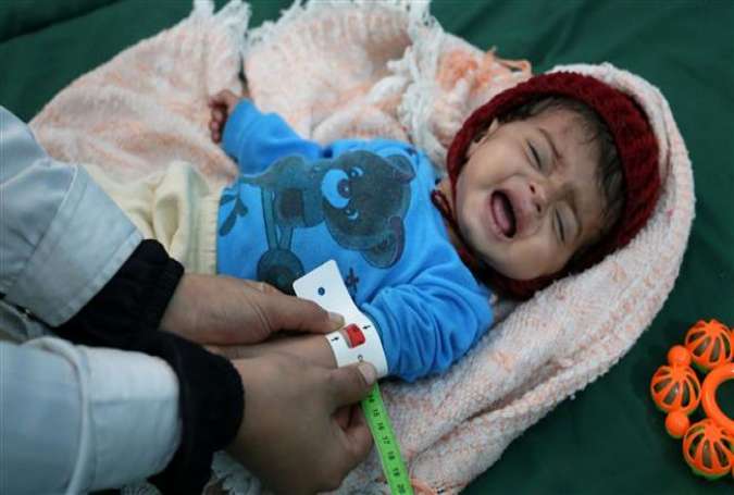 A malnourished Yemeni boy is attended to at a therapeutic feeding center in Ta