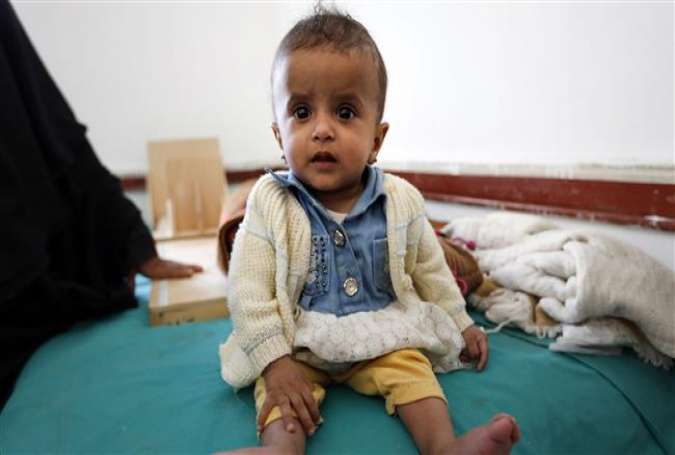 A Yemeni infant suffering from malnutrition waits for treatment at a medical center in Bani Hawat, on the outskirts of the Yemeni capital Sana’a, on January 9, 2017.