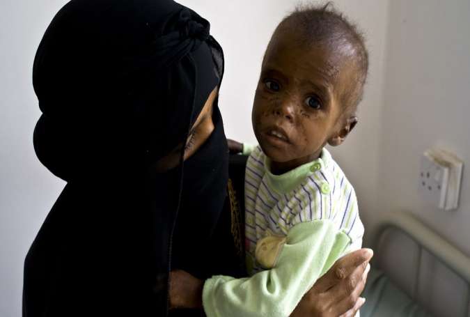 17 Million Yemenis Food Insecure under Saudi Siege
