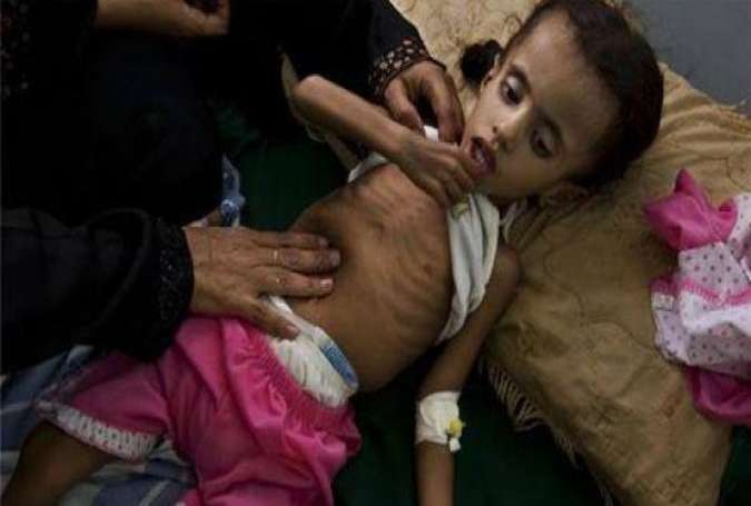 “ظروف تشبه المجاعة” في مناطق باليمن