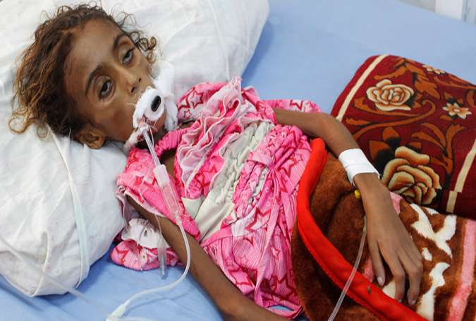 Malnourished girl Jamila Ali Abdu, 7, lies on a hospital bed before she died in Hodeidah, Yemen