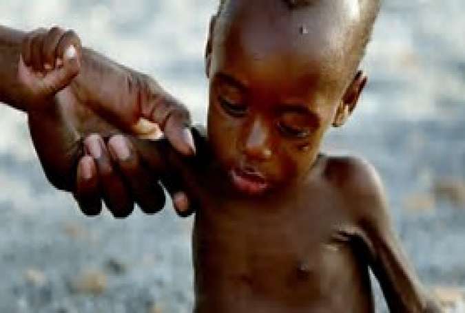 Kelaparan di Afrika dan Yaman, akibat perang yang dipaksakan.jpg