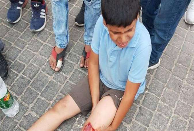A Palestinian child groans with pain after being run over by an Israeli settler in Silwan neighborhood on the outskirts of the Old City of Jerusalem al-Quds on August 10, 2017. (Photo by the Palestinian Information Center)