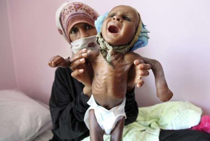 ایک کروڑ دس لاکھ یمنی بچے مدد کے منتظر ہیں، یونیسف کا انتباہ