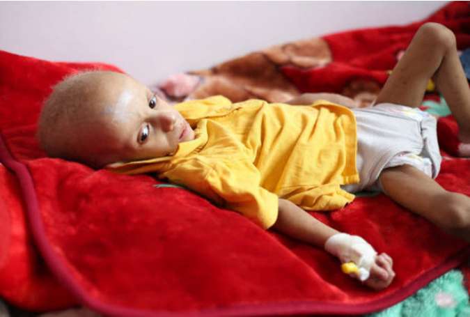 ورود ۲۰۰ تُن دارو و تجهیزات پزشکی به یمن