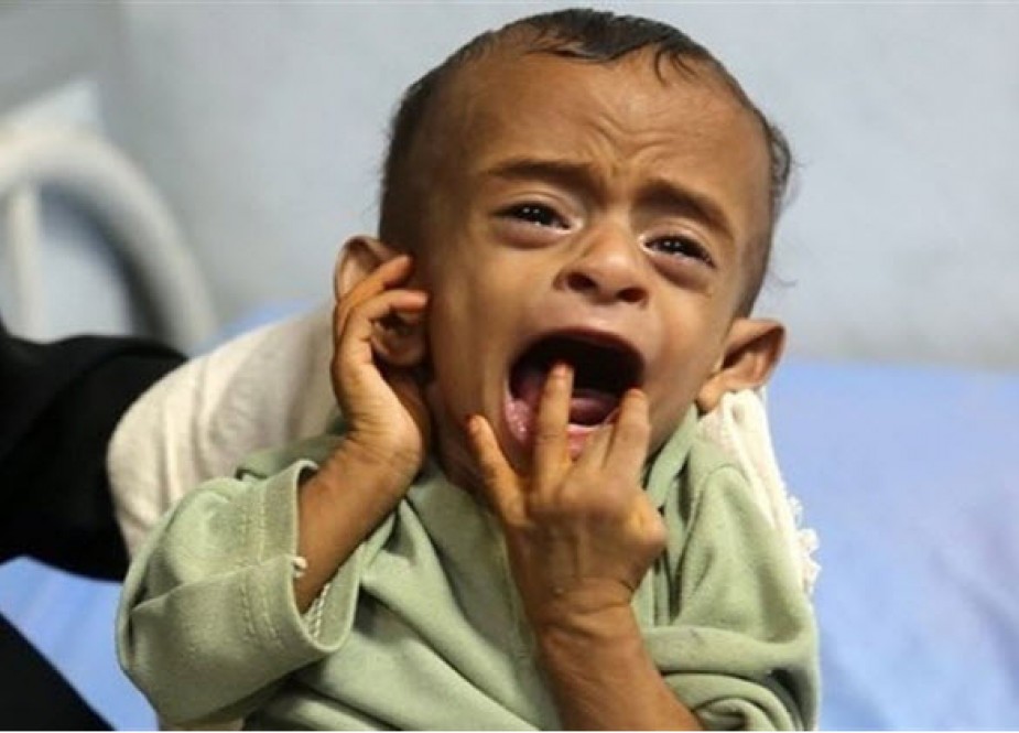 اوضاع فاجعه بار یمن به روایت صندوق نجات کودکان