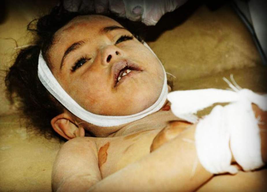 حمله به الحدیده و وقوع فاجعه ای انسانی برای 100 هزار کودک یمنی