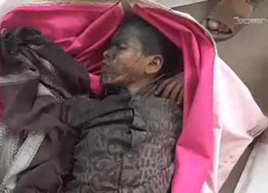 شهادت شماری از کودکان یمنی در پی بمباران جنگنده های سعودی