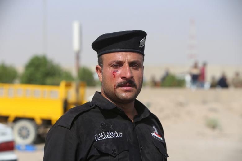 A wounded Iraqi policeman during a protest at the main entrance to the giant Zubair oilfield near Basra, July 17.