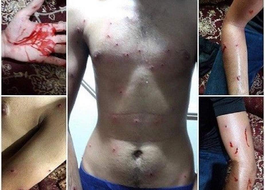 حمله ی مسلحانه ی آل خلیفه به عزاداران حسینی با سلاح شوزن