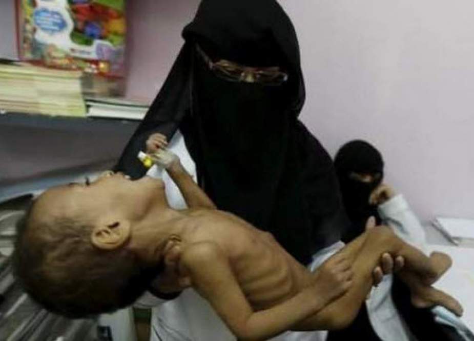 سازمان ملل: قحطی کامل ۱۲ میلیون یمنی را تهدید می‌کند