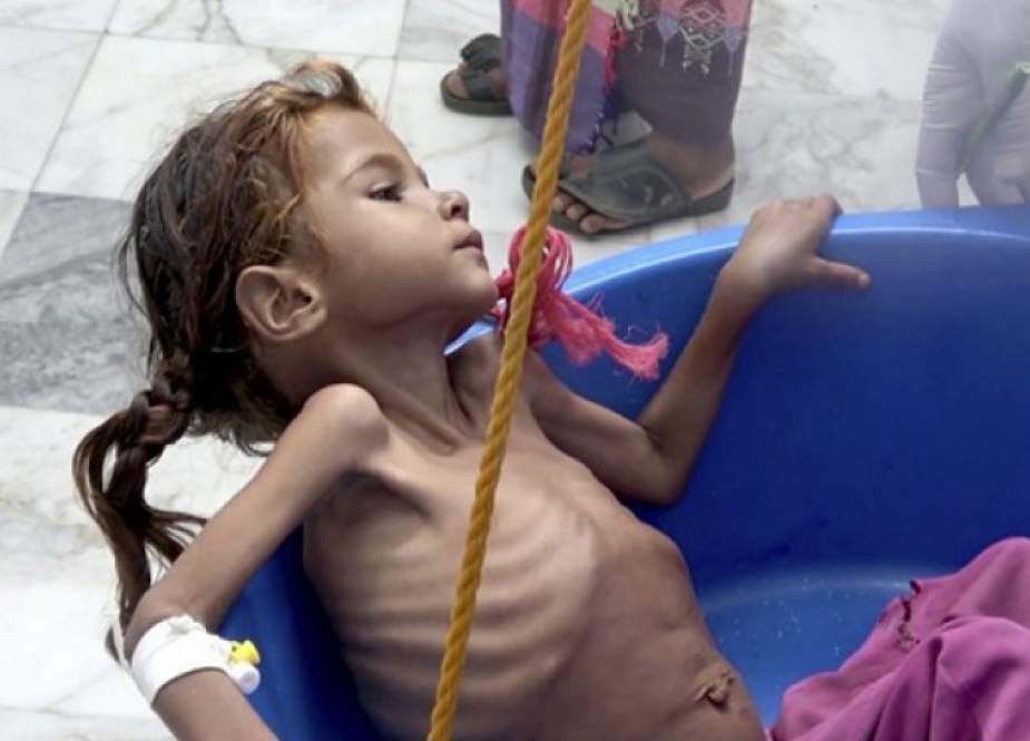 یمن را از گرسنگی نجات دهید.. تجاوز به یمن و هولناکترین فاجعه ی انسانی