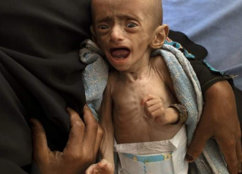 Khashoggi Versus 50,000 Slaughtered Yemeni Children