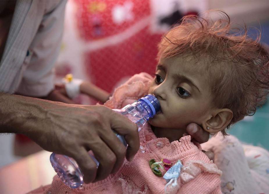 Anak Yaman, menghadapi kelaparan.jpg