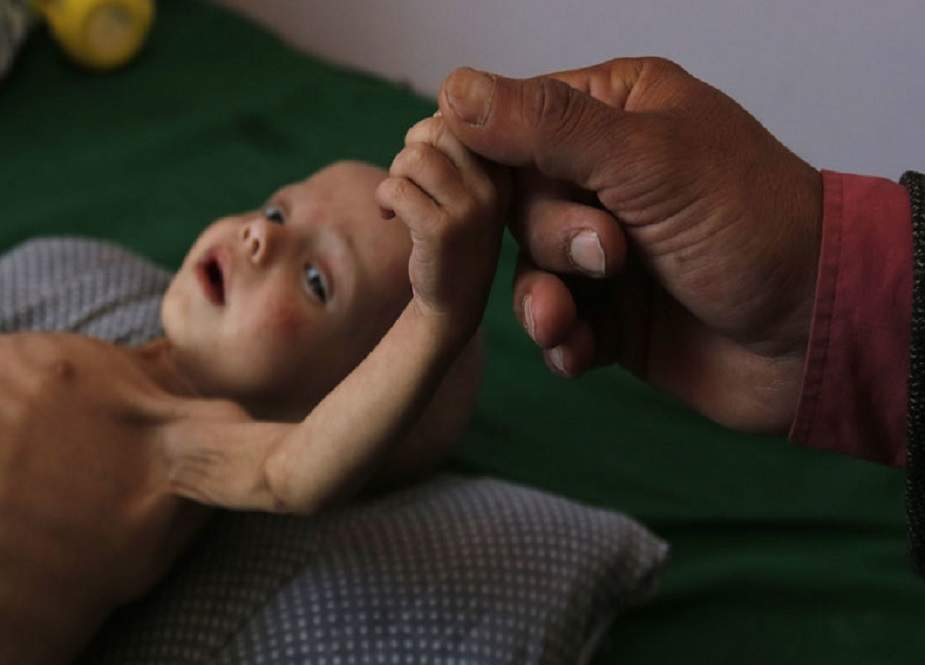 یمن بچوں کی مقتل گاہ، 85 ہزار بچے بھوک اور بیماری سے زندگی ہار چکے