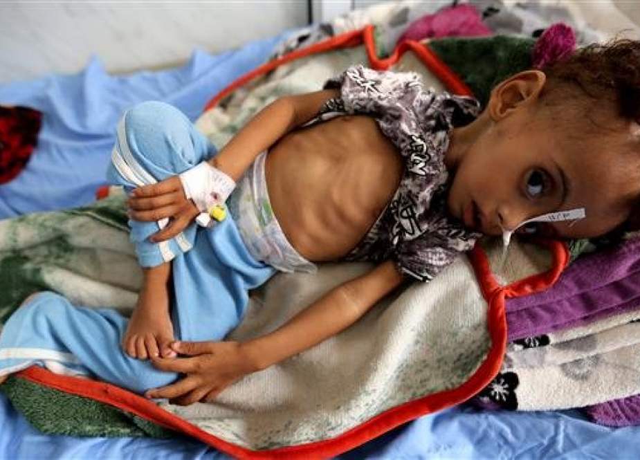 85,000 Yemeni Kids May Have Starved as Saudi Aggression: NGO
