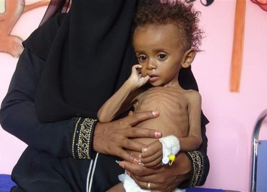 A Yemeni mother holds her malnourished child as they wait for treatment in a medical center in the village of al-Mutaynah, in Hudaydah province, Yemen. The AFP file photo was taken on November 29, 2018.